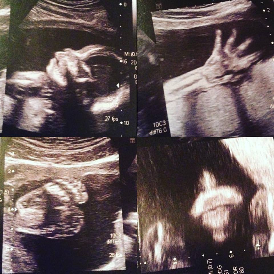 Gravidez 22 Semanas gestação gestante família family blog bebés ecografia ultrasound