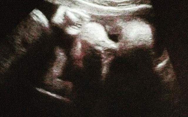 Bebé A Caminho – 37 Semanas